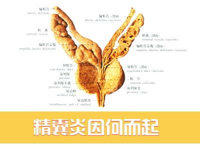 精囊炎